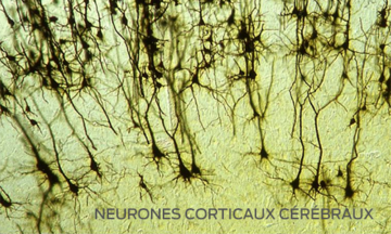 cerebral cortical neurons